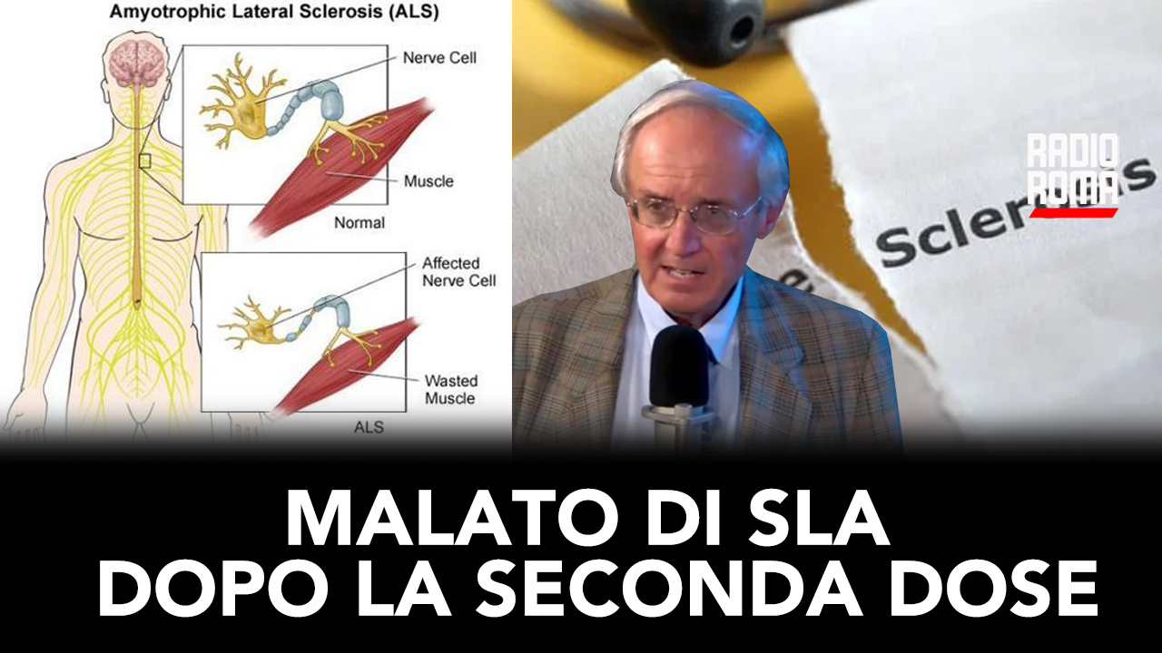 Malato di SLA dopo la seconda dose (con Silvio Sposito, 2/02/2024)