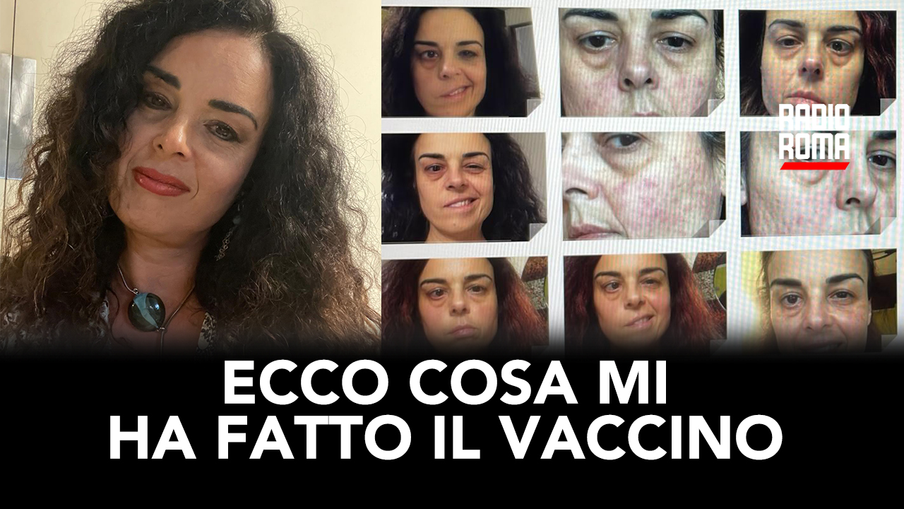 Ecco cosa mi ha fatto il vaccino (Con Emilia Padovano) (Video)