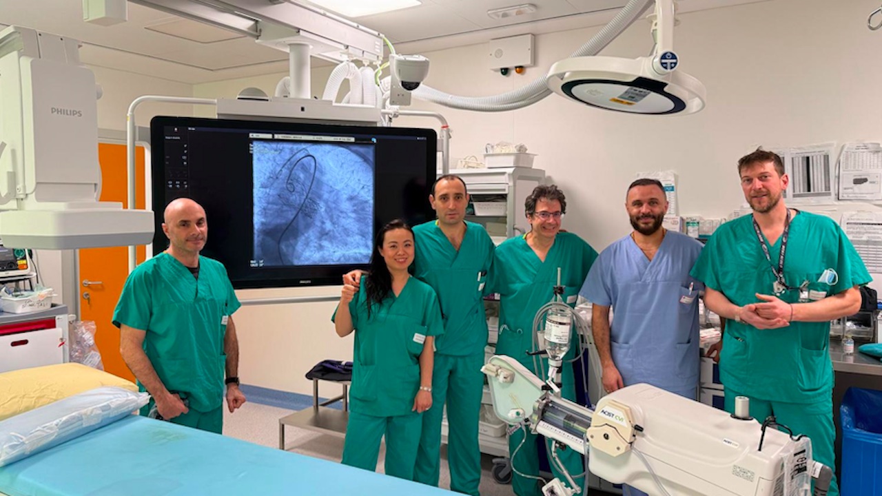 San Camillo, primo intervento al mondo Tavi in Tavi per sostituire protesi cardiaca su paziente con rara sindrome