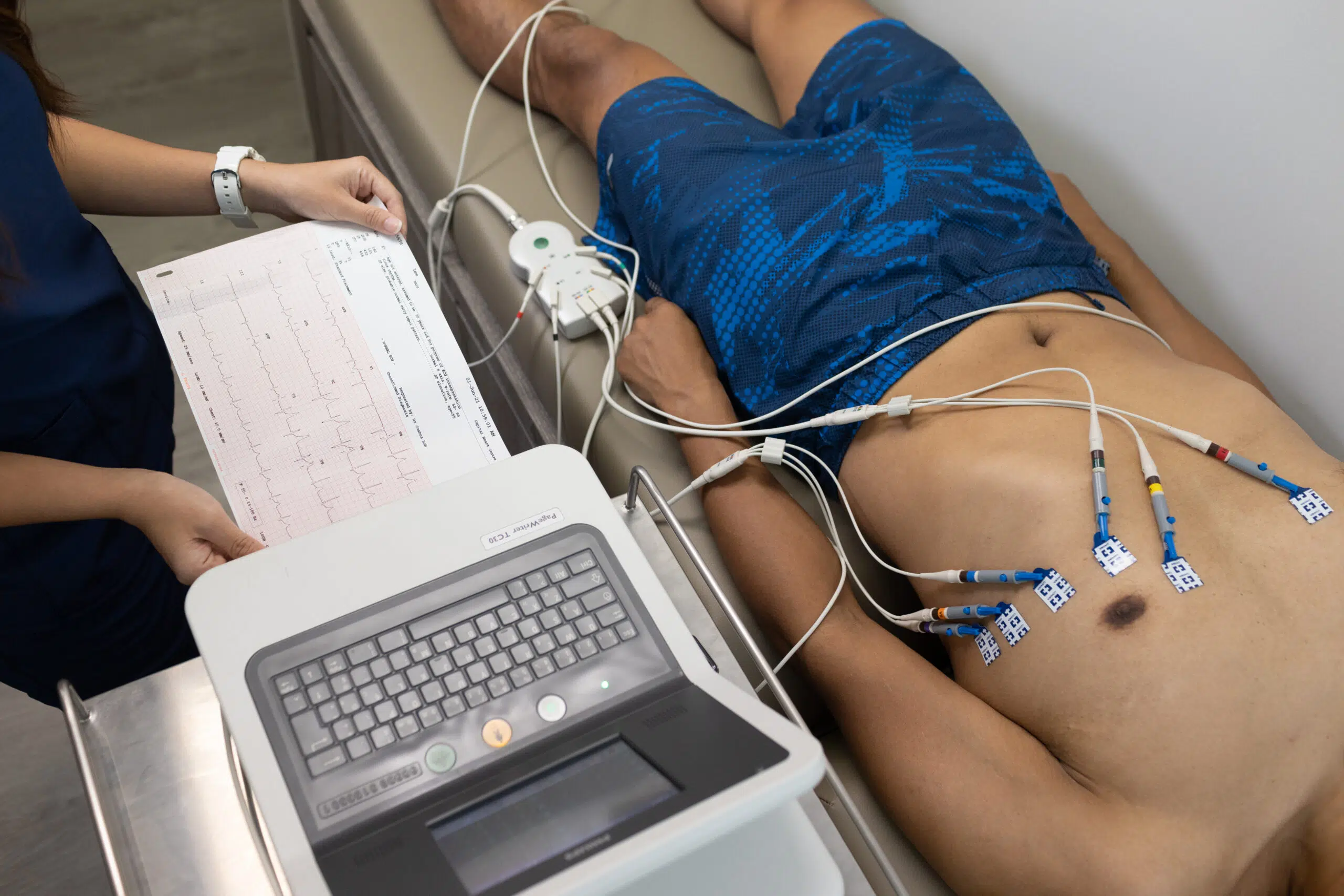 Salute, scompenso cardiaco: l'Intelligenza Artificiale ‘svela’ i segnali nascosti nell'ECG